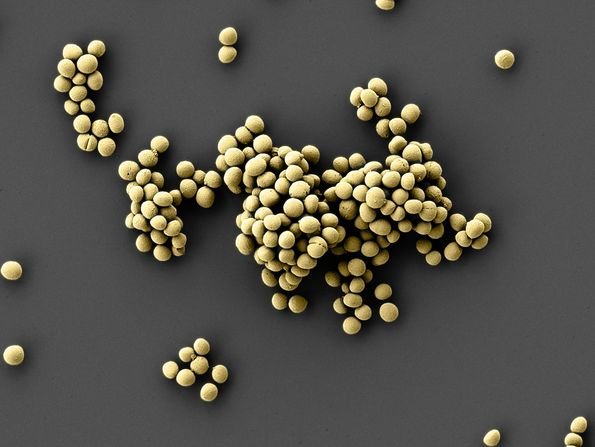 csm_2023-12-18-Staphylococcus_epidermis03_koloriert-en__gelb_8754ef1bb0.jpg
