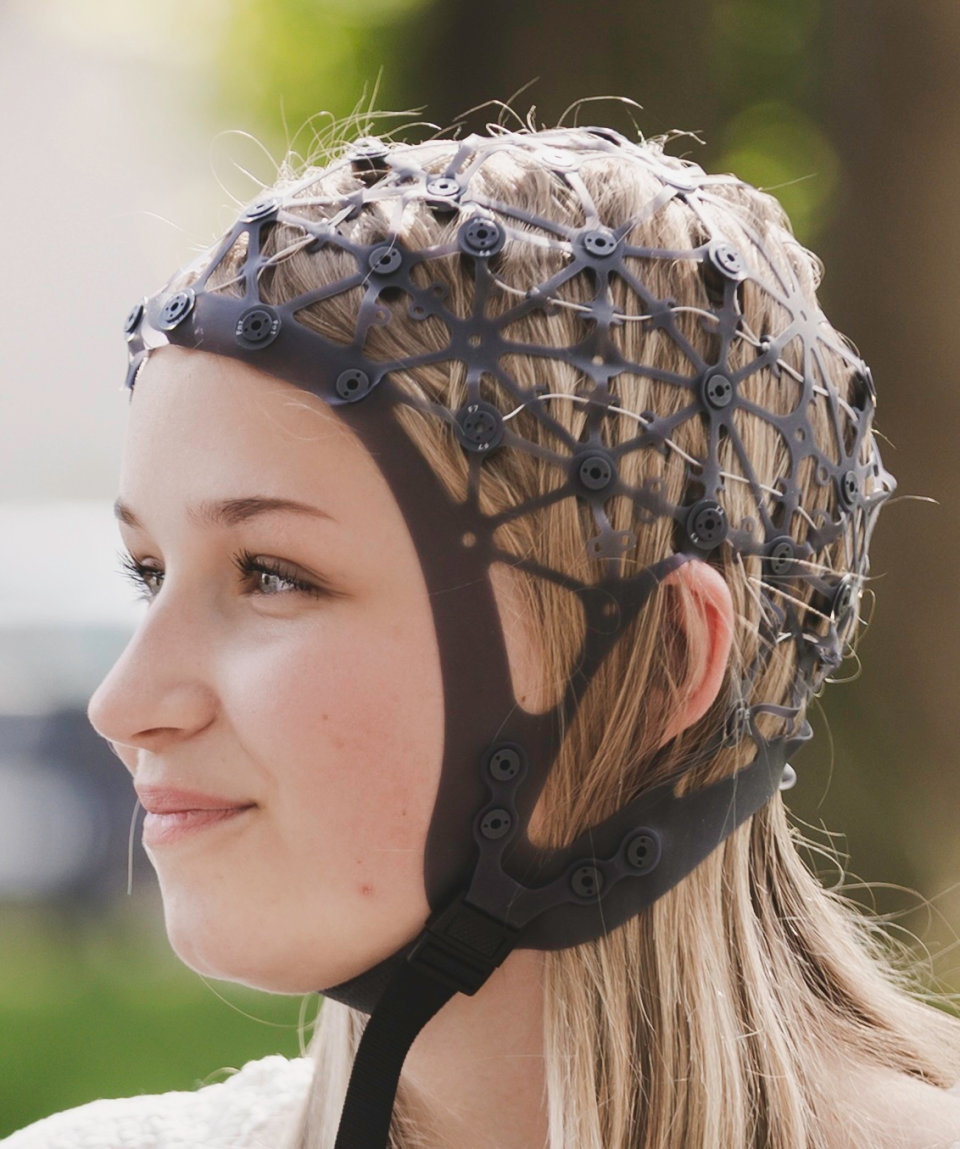 eng-Cap2_Cerebri.png