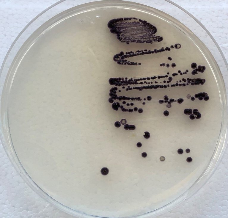 Kultur von Violaceinzellen in der Petrischale, welche sich schwarz vom weißen Nährboden abheben.
