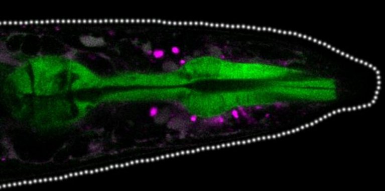 Eine Fluoreszenzaufnahme mit grün und pink leuchtenden Strukturen auf schwarzem Hintergrund.