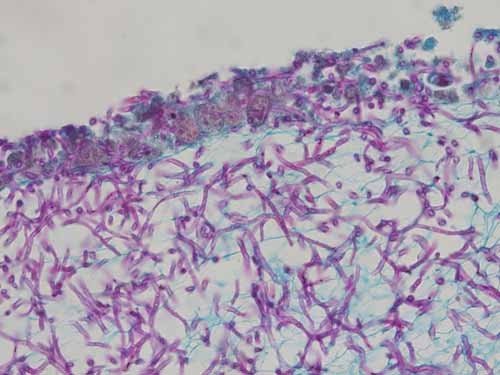 Viele klein lila gefärbte Pilzsporen befinden sich im durchsichtigen Gewebe, eine Mikroskopaufnahme.