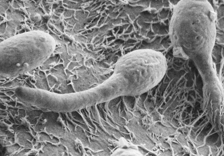 schwarz-weiße Aufnahme von stromlinienförmigen Pilzen unter dem Mikroskop