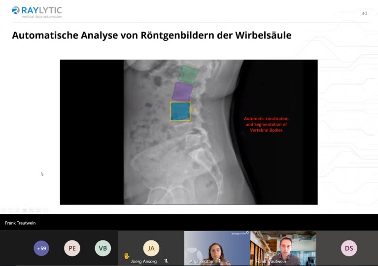 Dargestellt ist ein Röntgenbild vom Oberkörper eines Menschen, bei welchem einzelne Wirbelkörper farblich markiert wurden.