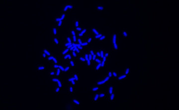 Chromosom