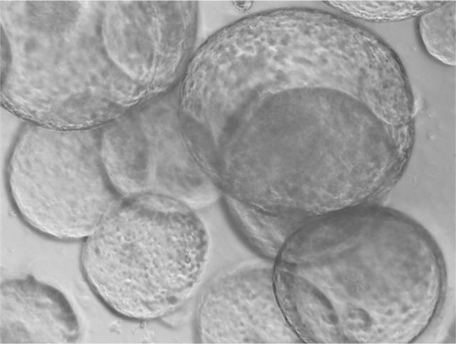 pankreas_organoide_in_kultur