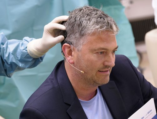 An Prof. Dr. Bernhard Hirt wird ein Cochlea-Implantat demonstriert. Hierzu wird ihm ein soches Implantat von einem Arzt an den Kopf gehalten.