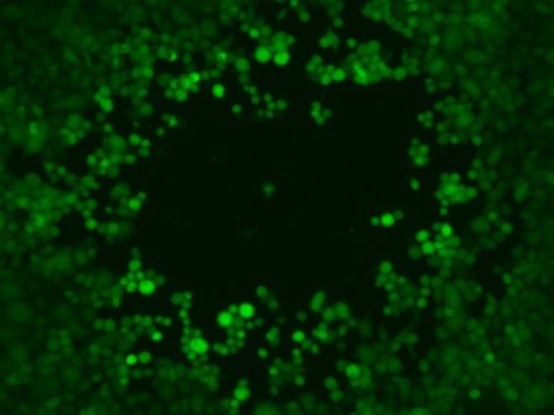 Beispielbild zur Plaquebildung von Zellkulturzellen durch einen engineerten, grün fluoreszierenden Herpes-simplex-Virus 1.